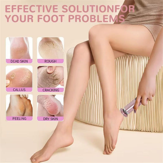 Electric Foot Callus Remover, 2in1 Rechargeable Foot File Callus Remover for Feet, Speeds Foot Scrubber Dead V1192-AZ-W-3335