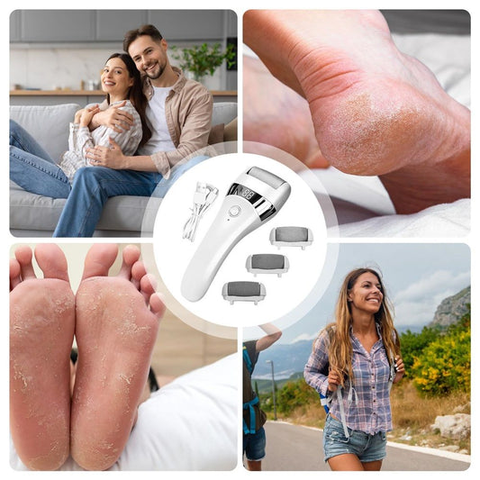 Electric Foot Files, Professional Waterproofs Battery Displays, Electric Callus Remover for Feet | for V1192-AZ-W-9221