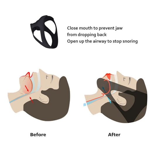 Adjustable Anti Snoring Chin Strap, Black, Stop Snoring Belt V1237-ZY-506-0190