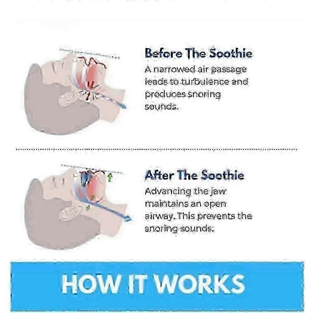Honex Anti-Snoring Mouthpiece - Quite Night Device, PC+EVA V1263-JX-6029