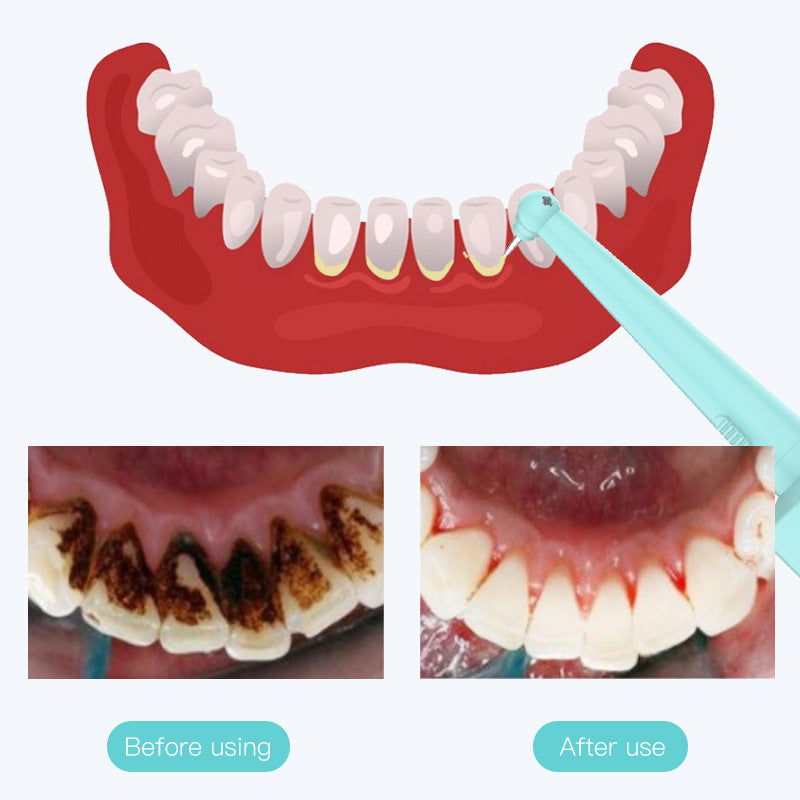 Intelligent High-Frequency Vibration Dental Calculus & Stain Remover(pink) V888-ELOSUNG29666