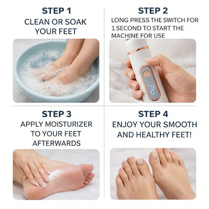 Electric Foot Callus Remover | USB Rechargeable V1106-DSZ-XXX-N
