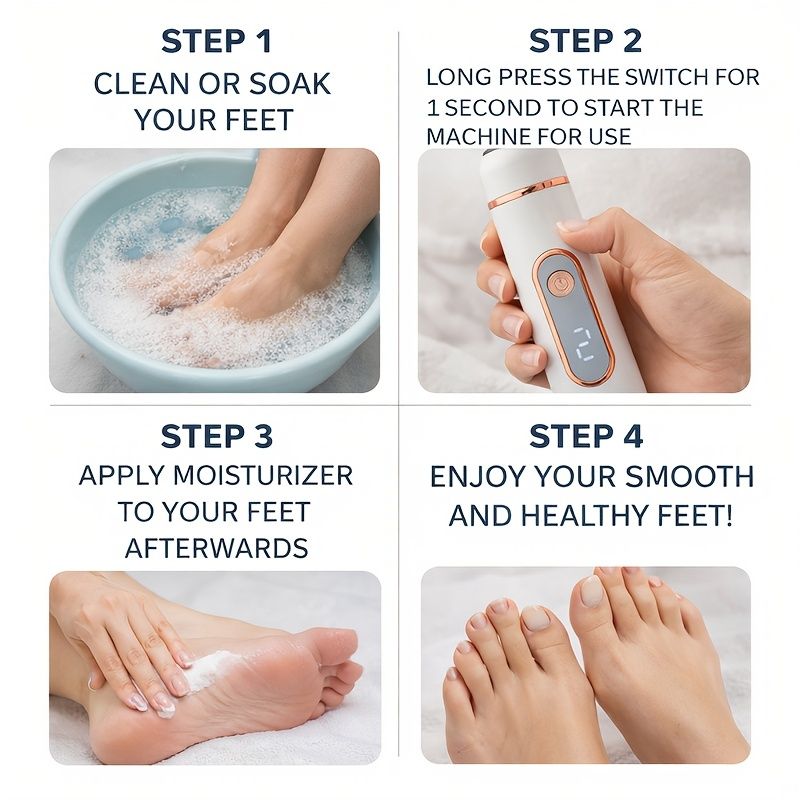 Electric Foot Callus Remover | USB Rechargeable V1106-DSZ-XXX-NN