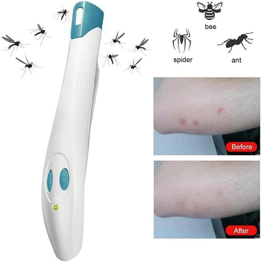 Portable Anti-Itch Pen for Bug Bites - Electronic Relief Device for Mosquito, Bee, Spider & Ant Stings, V1107-CS-BXSZYB