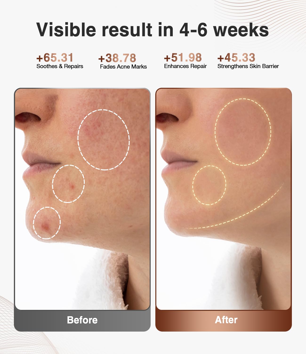 High-Performance 3D LED Beauty Mask - 4 Light Modes, 328 LEDs, Wireless Operation, Adjustable Timer, V1107-CS-NFMRYMZ