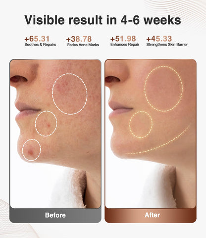 High-Performance 3D LED Beauty Mask - 4 Light Modes, 328 LEDs, Wireless Operation, Adjustable Timer, V1107-CS-NFMRYMZ