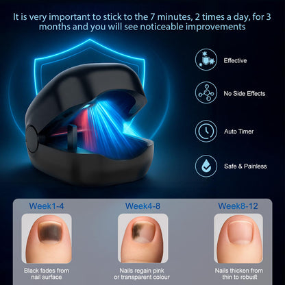 Nail Wellness Light Device (1-Piece): Red & Blue LED for Daily Nail Care Routine - Auto Timer, USB V1107-CS-ZJD