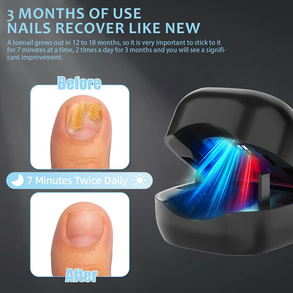 Nail Wellness Light Device (1-Piece): Red & Blue LED for Daily Nail Care Routine - Auto Timer, USB V1107-CS-ZJD
