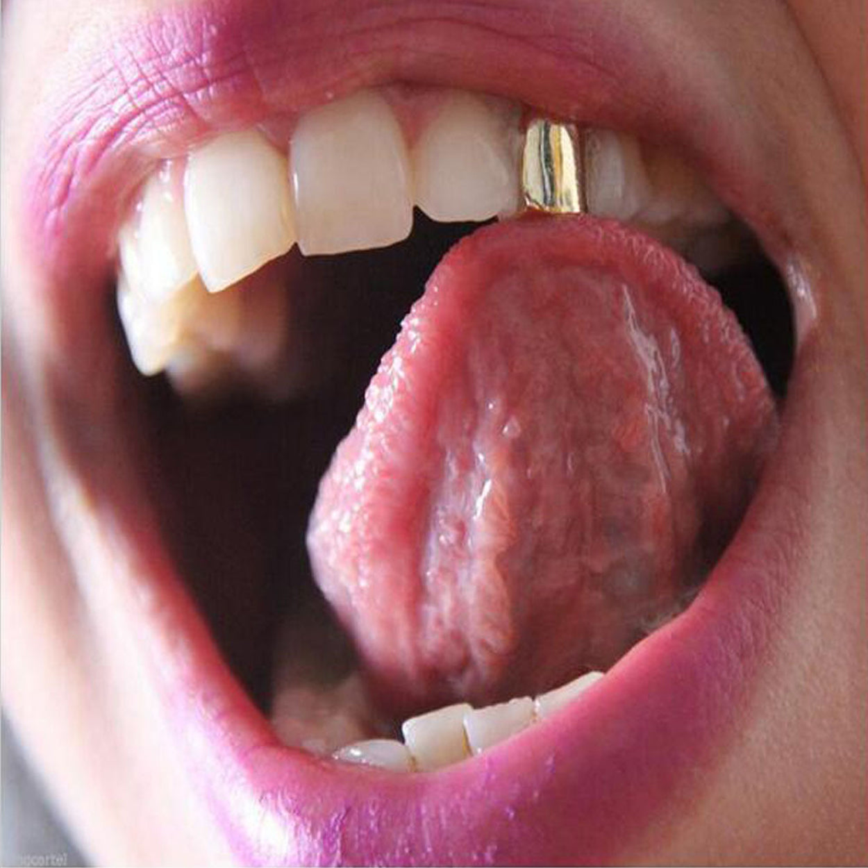 Hiphop Gold Tooth Jewelry Compatible with A$AP V1188-CE-Y1400515