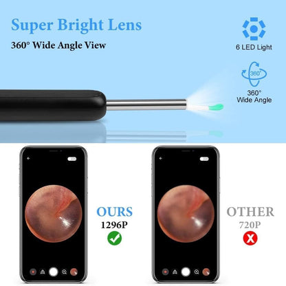 Wireless Smart Ear Cleaner with Camera for Safe Ear Inspection V1188-MS-325-0018