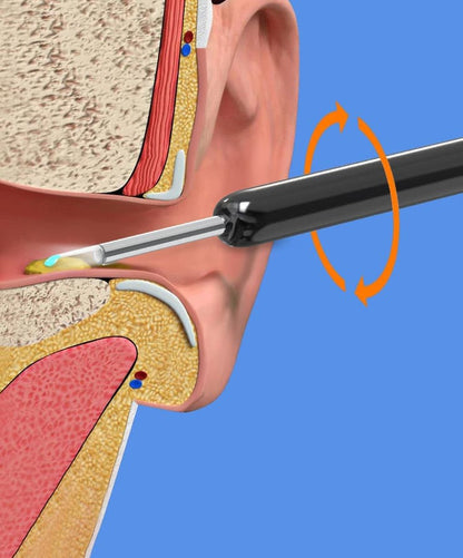 Smart Ear Cleaner with 1296P HD Camera, Wireless Earwax Removal WiFi Endoscope, Safe Inspection Intelligent V1188-MS-325-0086