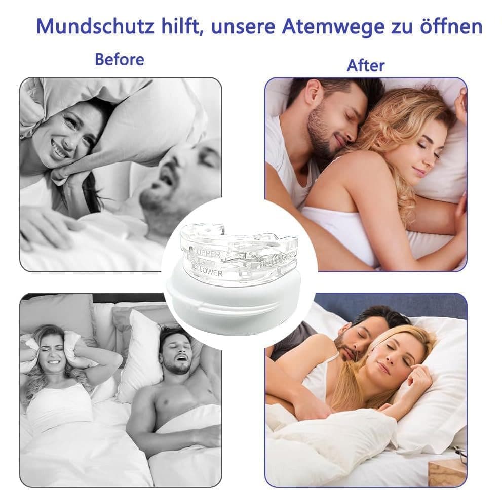 Orthodontic mouthguard for snoring and teeth grinding, comfortable night sleep aid, white V1188-MS-325-0284