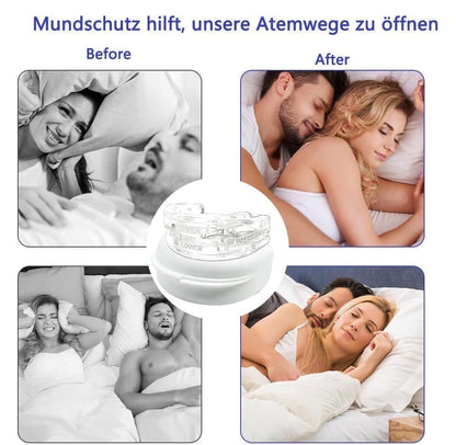Orthodontic mouthguard for snoring and teeth grinding, comfortable night sleep aid, white V1188-MS-325-0284