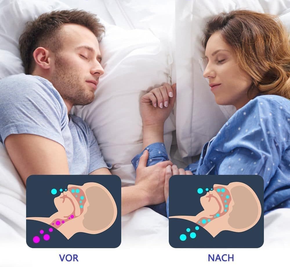 Night use orthodontic mouthguard anti-snoring bite guard, comfortable, blue V1188-MS-325-0285