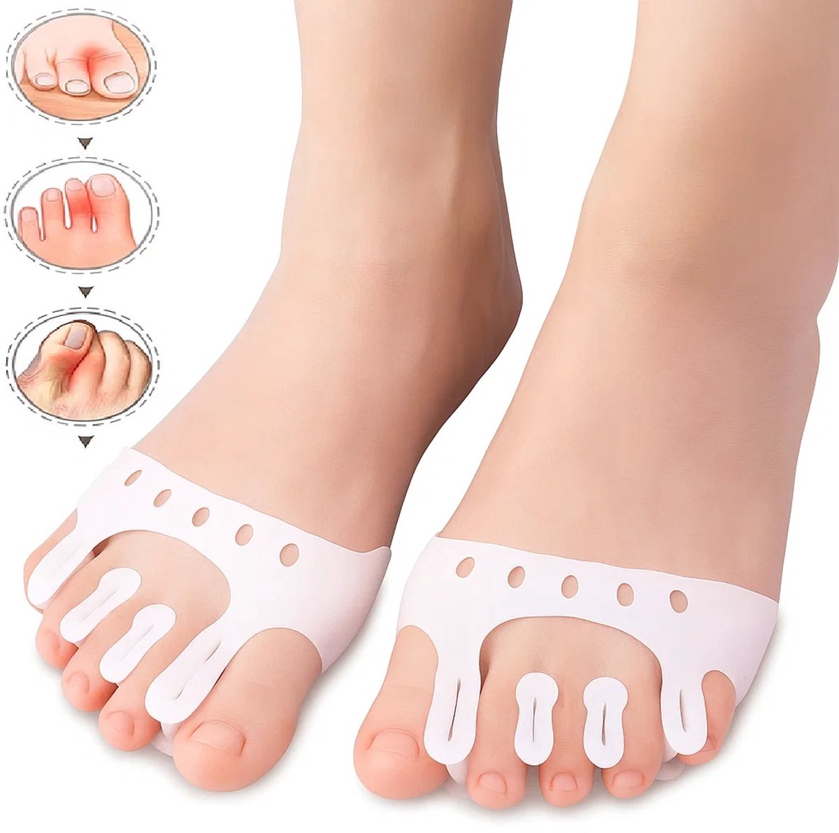 Silicone Toe Corrector 5-Hole | Toe Spreader | Hallux Valgus | Straighten Toes | Shock Absorbing | With Holes V1188-MS101-00096-1