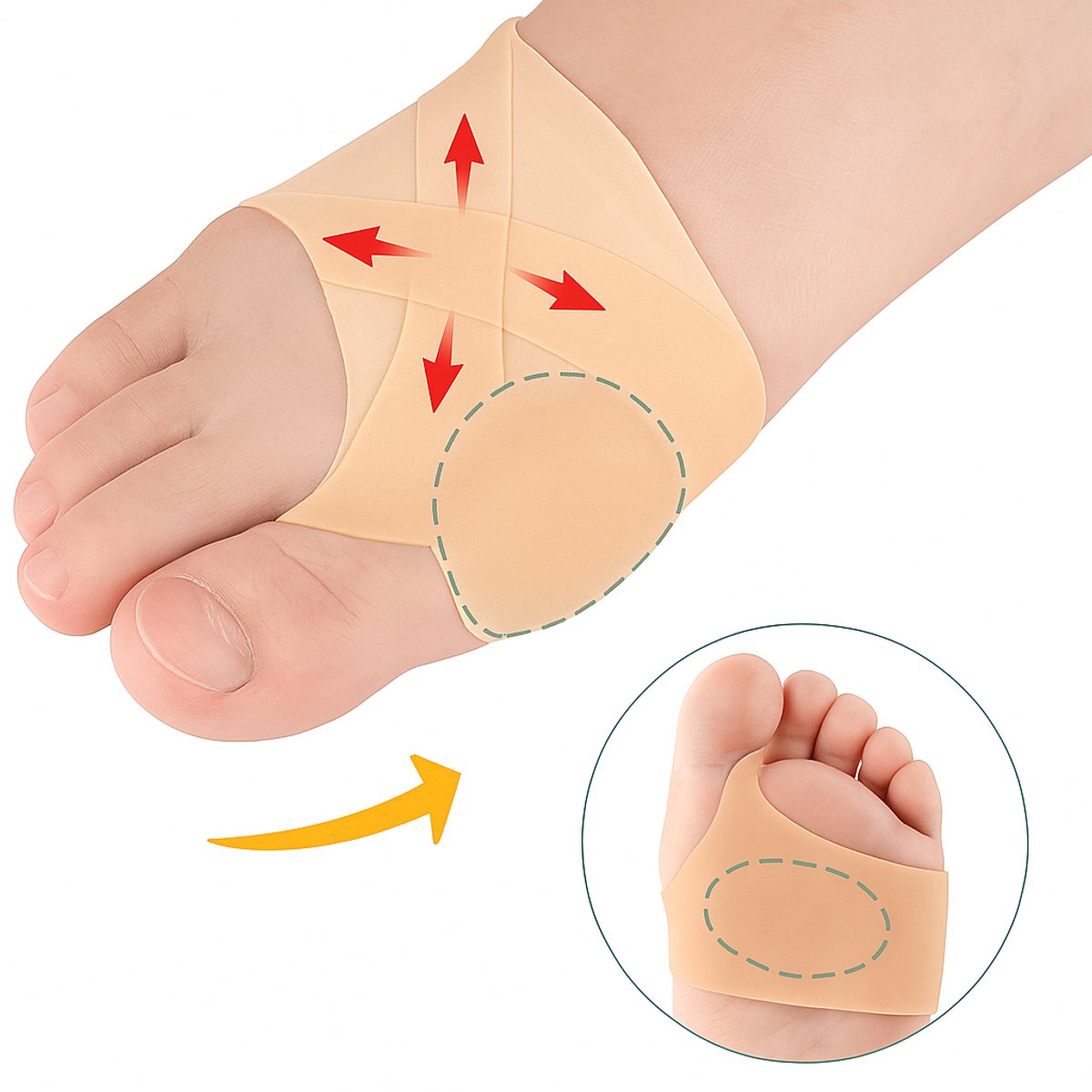 Hallux Valgus Silicone Toe Protectors | Toe Separators | Toe Corrector | Bunion | Bunion | Callus | Toe V1188-MS101-00166-1