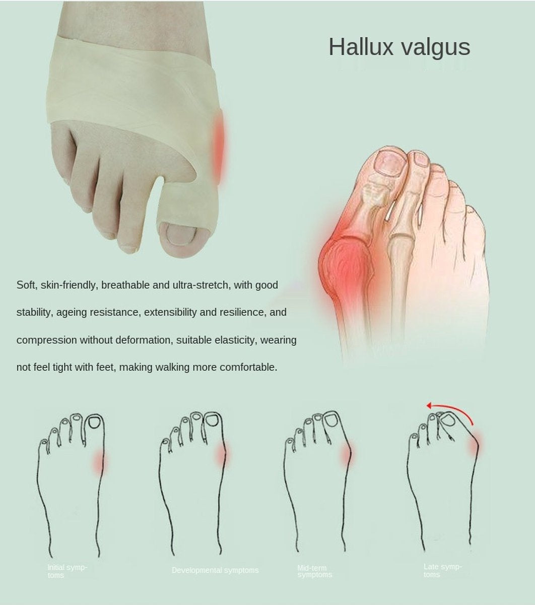 Hallux Valgus Silicone Toe Protectors | Toe Separators | Toe Corrector | Bunion | Bunion | Callus | Toe V1188-MS101-00166-1