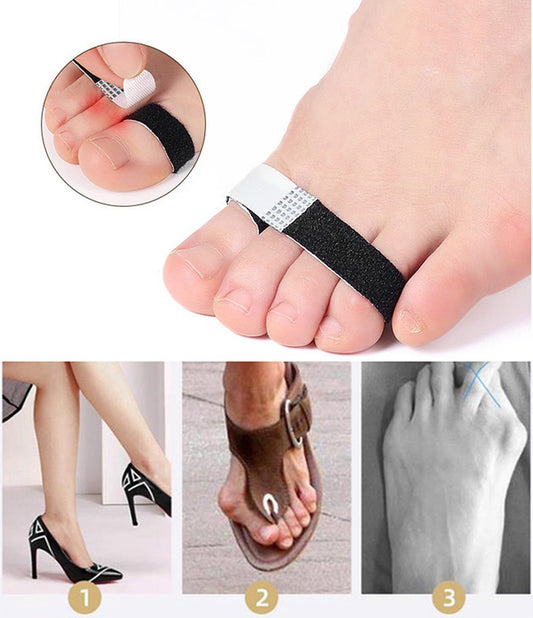 Toe Brace I Toe Bandage I Finger Brace I Finger Bandage I Toe And Finger Corrector I Toe Wrap I 1 Pair I White V1188-MS101-00188-1
