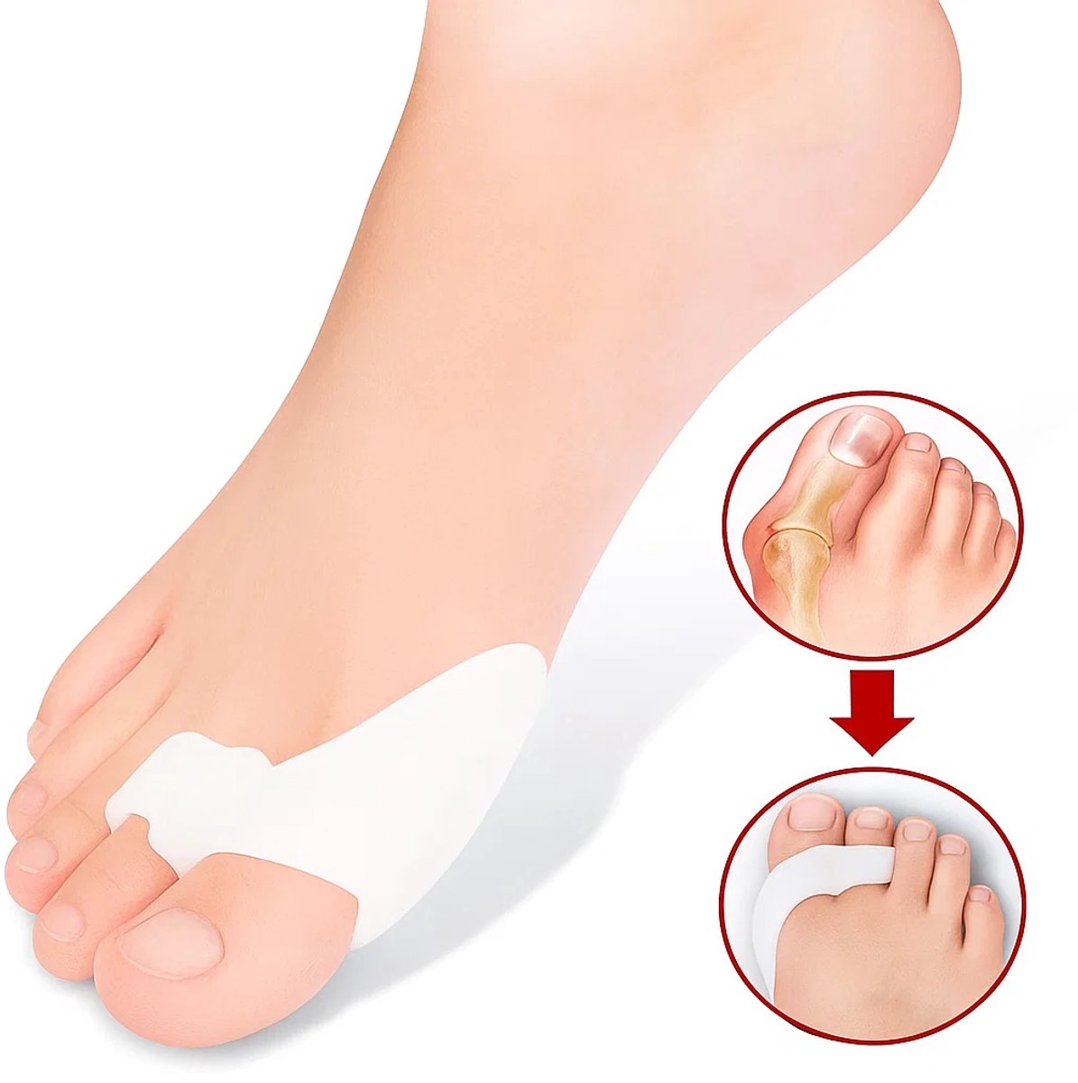 Silicone Toe Corrector | Toe Spreader | Hallux Valgus | Big and Little Toe Protector | 1 Pair V1188-MS101-00208-1