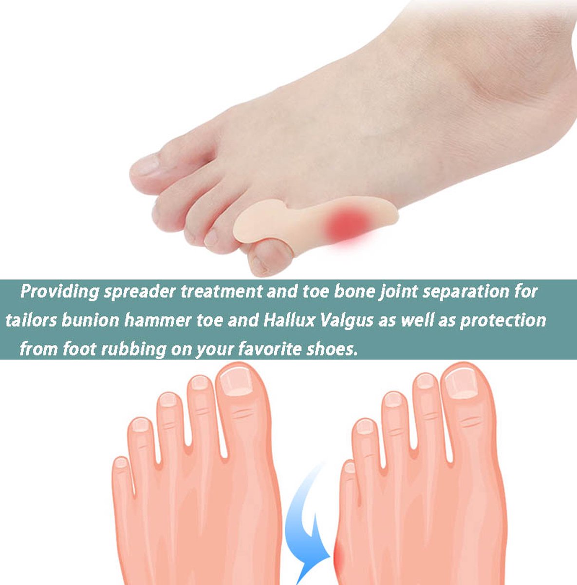 Silicone Toe Corrector Little Toe | Toe Spreader | Little Toe Protector | 1 Pair | Beige V1188-MS101-00325-1
