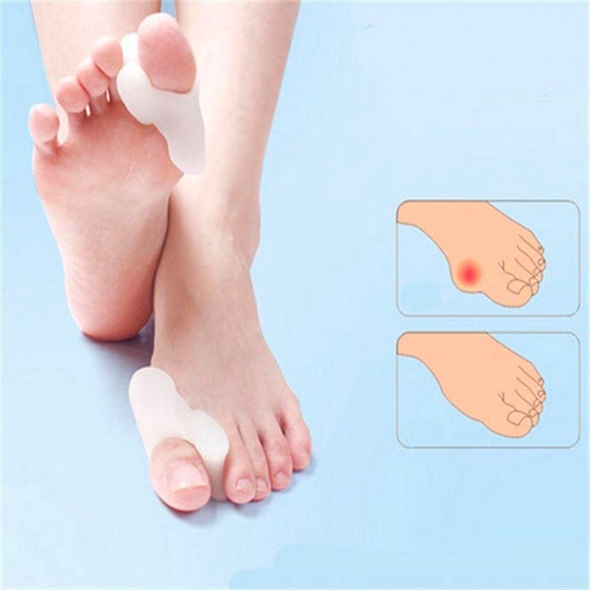 4x silicone big toe corrector/spreader (hallus valgus) V1188-MS101-00348-1