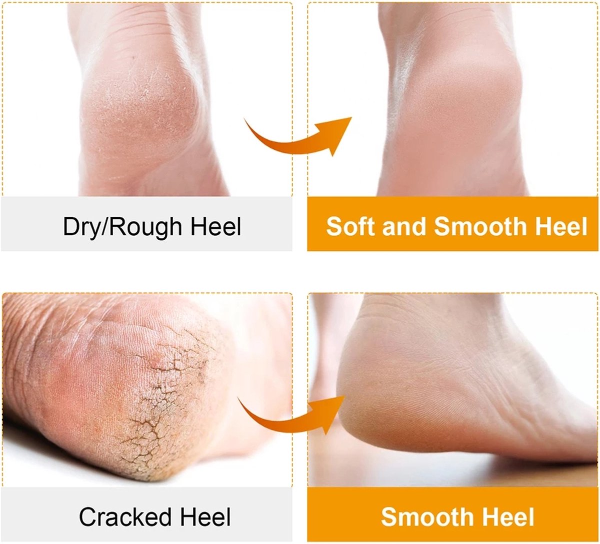 Pair Silicone Gel Socks | Heel Protectors | Heel Insoles | Heel Cushions | Heel Socks | One Size | Beige V1188-MS101-00546-1