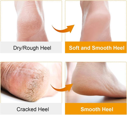 Pair Silicone Gel Socks | Heel Protectors | Heel Insoles | Heel Cushions | Heel Socks | One Size | Beige V1188-MS101-00546-1