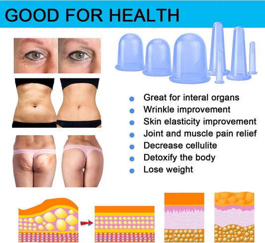 Cellulite Cups - Cupping For Cellulite - Premium Quality Cupping Set (7-Piece) - Cupping Cups - Full Body - V1188-MS101-02050-1