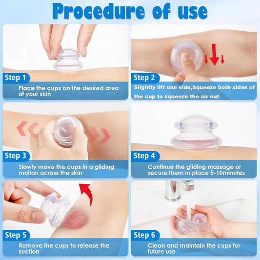 4 pieces silicone cups - Cupping cups - Cupping Set - Cellulite Cups - Cupping For Cellulite - vacuum cup - V1188-NK-BOL-518