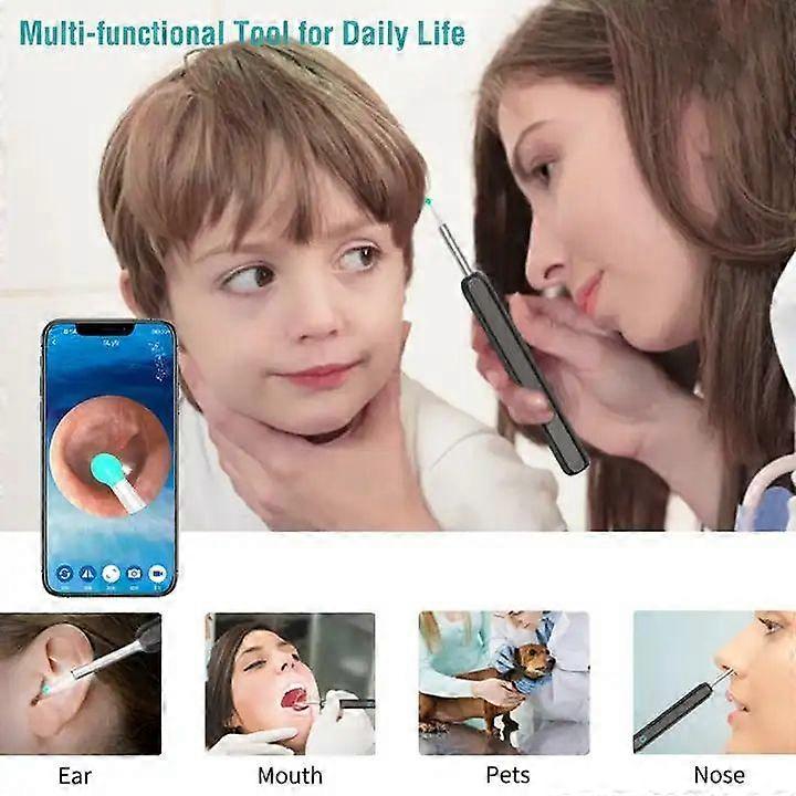 Wireless Smart Visual Ear Cleaner Usb WiFi Otoscope TW1 Ear Wax Removal Tool Set with Camera Ear Endoscope HD V1188-XYFN-6600256-1