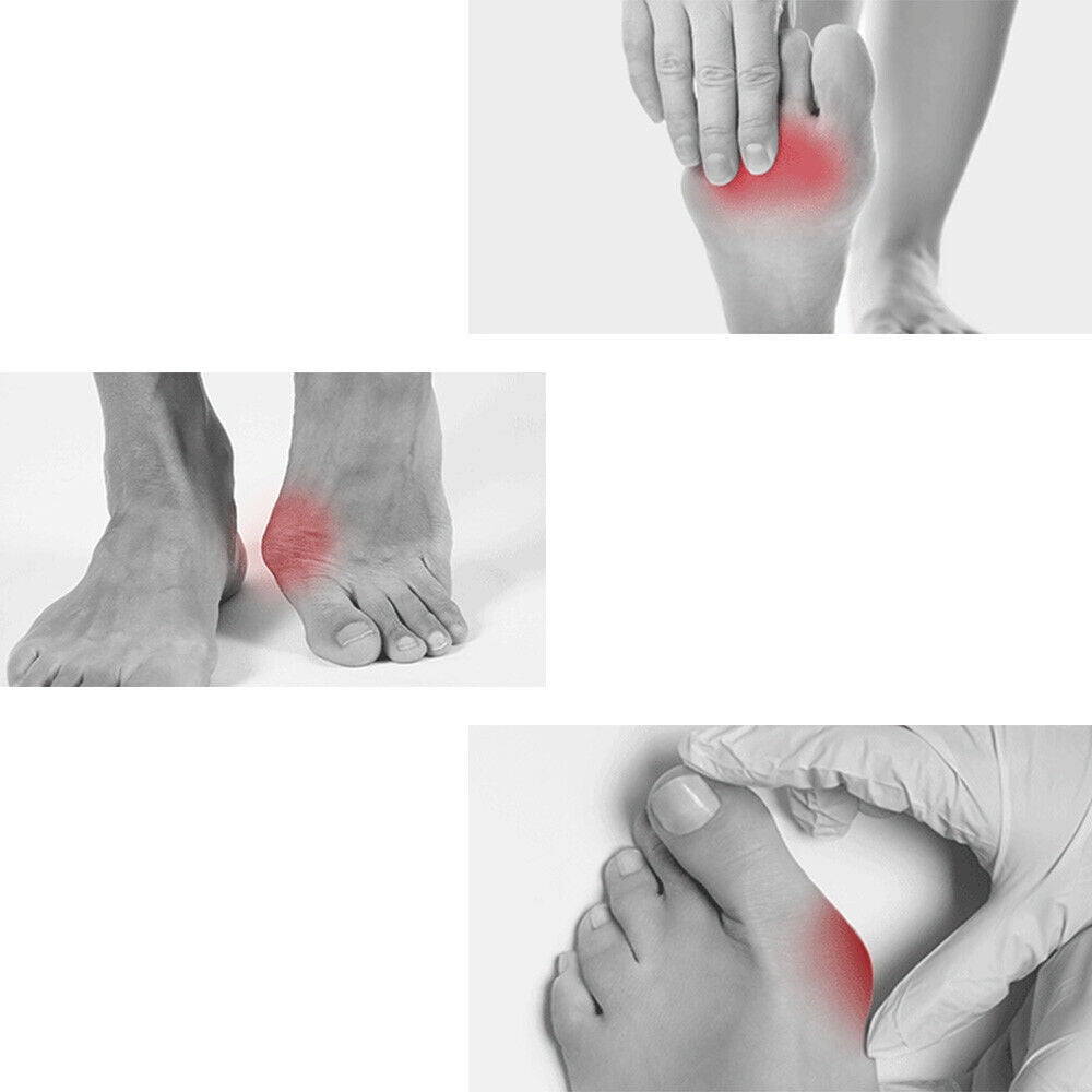 Onemayship Silicone Gel Toe Separator Orthotics Bunion Toes Spacer Pain Reliever 12Pcs V1189-LWWAL-20260325-00523