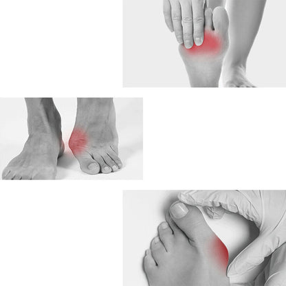 Onemayship Silicone Gel Toe Separator Orthotics Bunion Toes Spacer Pain Reliever 12Pcs V1189-LWWAL-20260325-00523