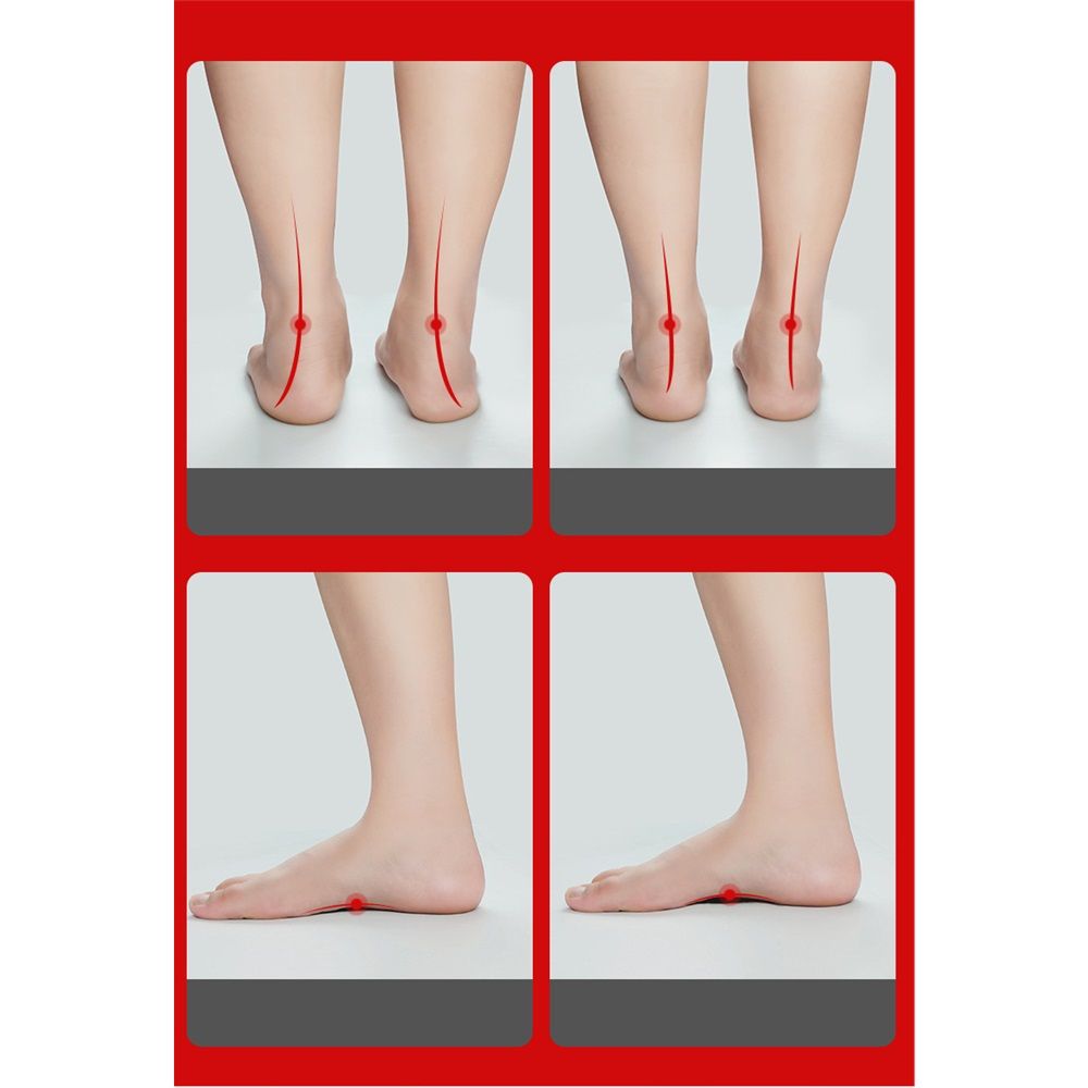 Shoe Pads 1 Pair Arch Support Inserts Plantar Insoles for Flatfoot Corrector Shoe Pads with Hole (White) Heel V1192-AZ-W-0990