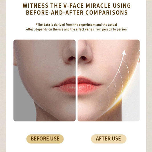 Intelligent Electric Double Chin and V-Shaped Face Machine with 12Adjustable Intensities - Women's V-Face V1192-AZ-W-2909
