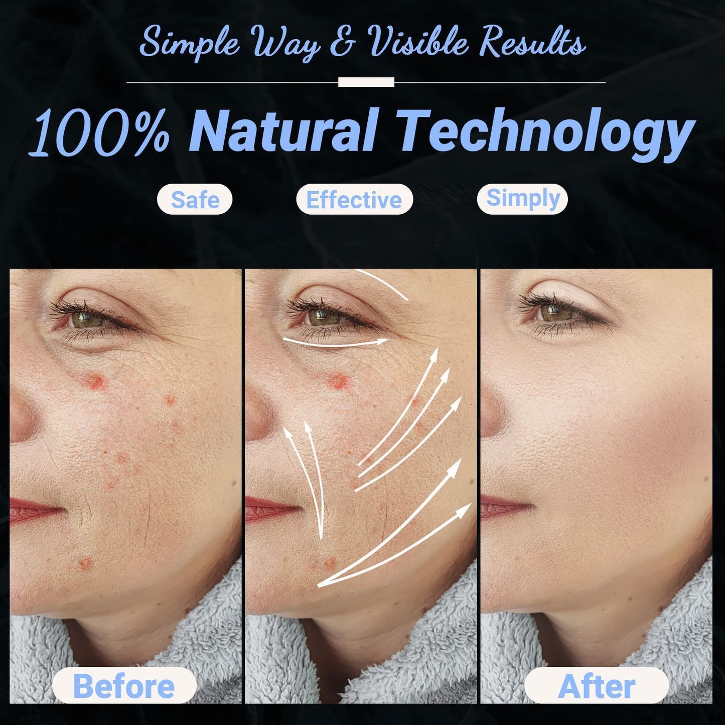 High Frequency Facial Machine - Portable Handheld High Frequency Facial Skin Wand Machine with 4 Different V1192-AZ-W-3631