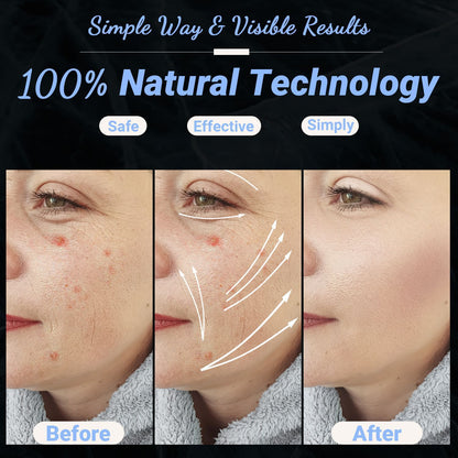High Frequency Facial Machine - Portable Handheld High Frequency Facial Skin Wand Machine with 4 Different V1192-AZ-W-3631