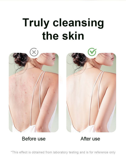 Multi-Function Electric Body Brush: 360 degrees Rotation, Auto-Cleaning, 5 Brush Heads, 3-Speed Adjustment, V1232-DDMYS002