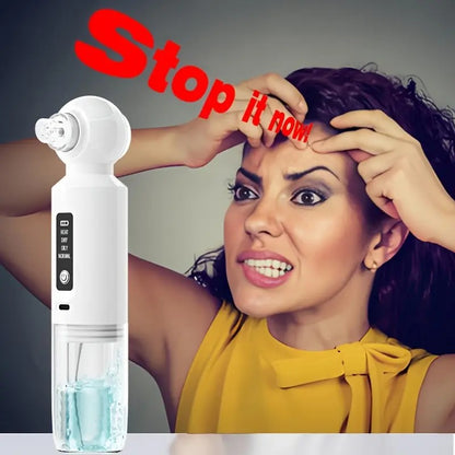 Six-head blackhead cleaner with electric vacuum suction for deep pore cleaning. USB-rechargeable mini bubble V1232-HTQJY001
