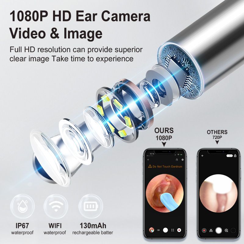 8-Piece Smart Visual Ear Cleaner, 1080P HD AI Warning, IP67 Waterproof Silicone Soft Tip, Safe and V1232-KSCHQ001