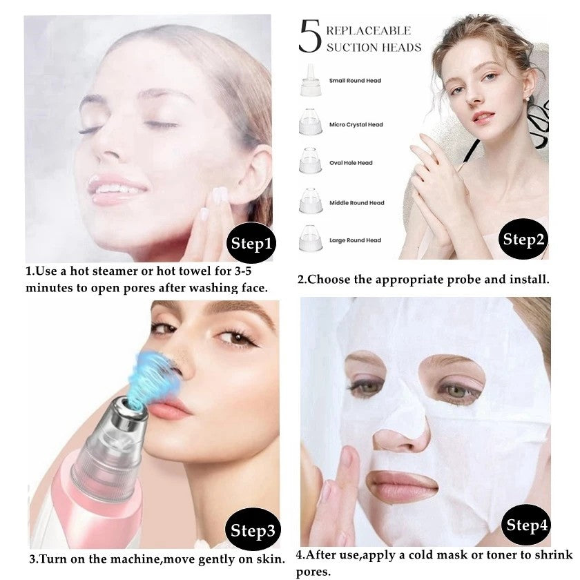 Blackhead Cleansing Device: 5 Nozzles for Full Face, 3 Suction Levels for Targeted Cleansing V1232-QHTY001