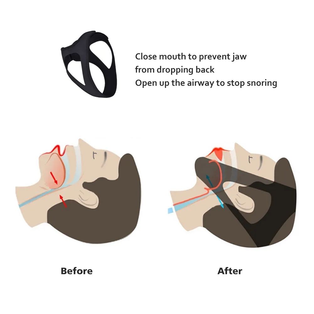 Adjustable Anti Snoring Chin Strap, Black, Stop Snoring Belt V1237-ZY-506-0190