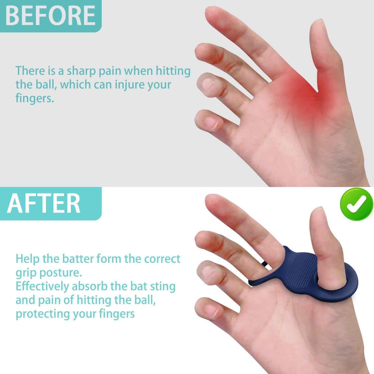 Blue Thumb Grips Finger Protectors for Thumb Tips - 1 Pair V1258-DP02-BOL-137