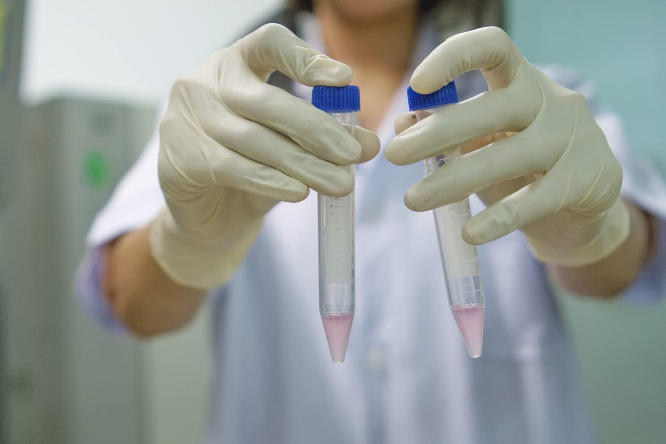 Ackers Conical Centrifuge Tubes 15mL, 100 Pcs Sterile Plastic Test Tubes with Screw Caps, Polypropylene V1258-DP02-C-65