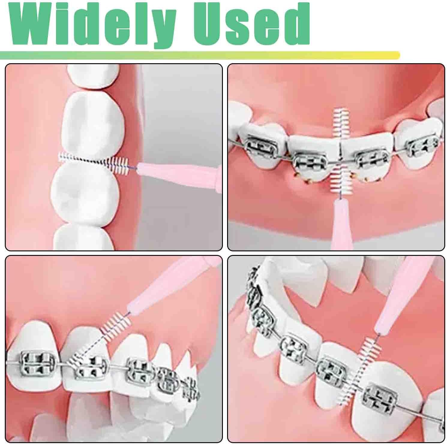 100pcs Interdental Brhes Dental Cleaning Tools Tooth Floss Picks Oral Hygiene Toothpicks V1258-DP02-E-337