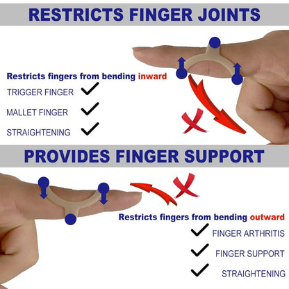 6Pcs Oval inger Splints, Trigger inger Splint or Trigger/Mallet/Arthritis/Straightening, inger Brace Support, V1259-DP01-E-481