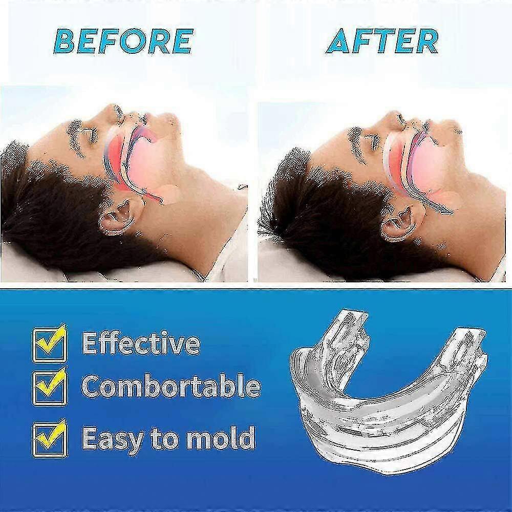 Adjustable Anti Snoring Mouthpiece Guard Anti Snore Sleep Apnea Teeth Grind V1263-JX-166