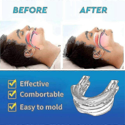 Adjustable Anti Snoring Mouthpiece Guard Anti Snore Sleep Apnea Teeth Grind V1263-JX-166