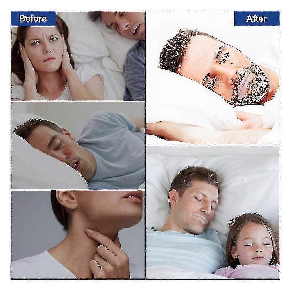 Sleep Strips Mouth Tape For Better Breathing Relief V1263-JX-171