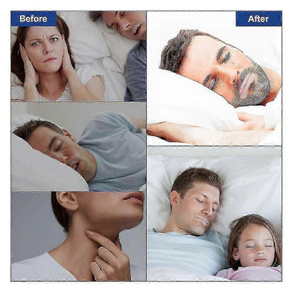 Sleep Strips Mouth Tape For Better Breathing Relief V1263-JX-171
