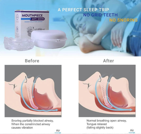 Anti-snoring devices, adjustable anti-snoring devices, snoring aids for men and women, anti-snoring aids for V1263-JX-3106